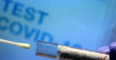 109 са новите случаи на коронавирус в страната